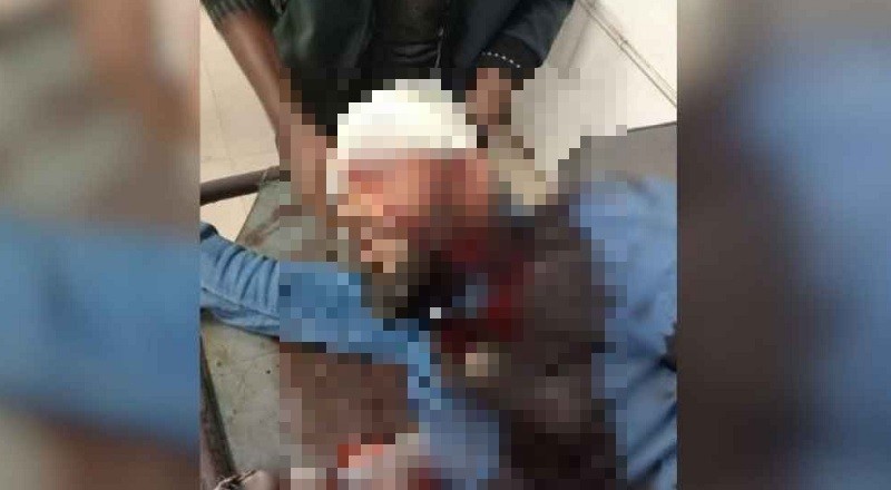 এবার খুলনায় এনসিপি নেতাকে প্রকাশ্যে গুলি